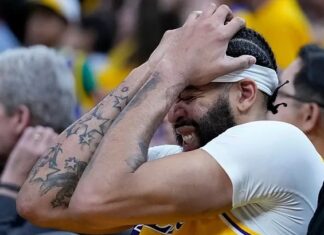 Anthony Davis of the Los Angeles Lakers with a head injury