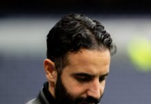 Manchester United has a big dilemma